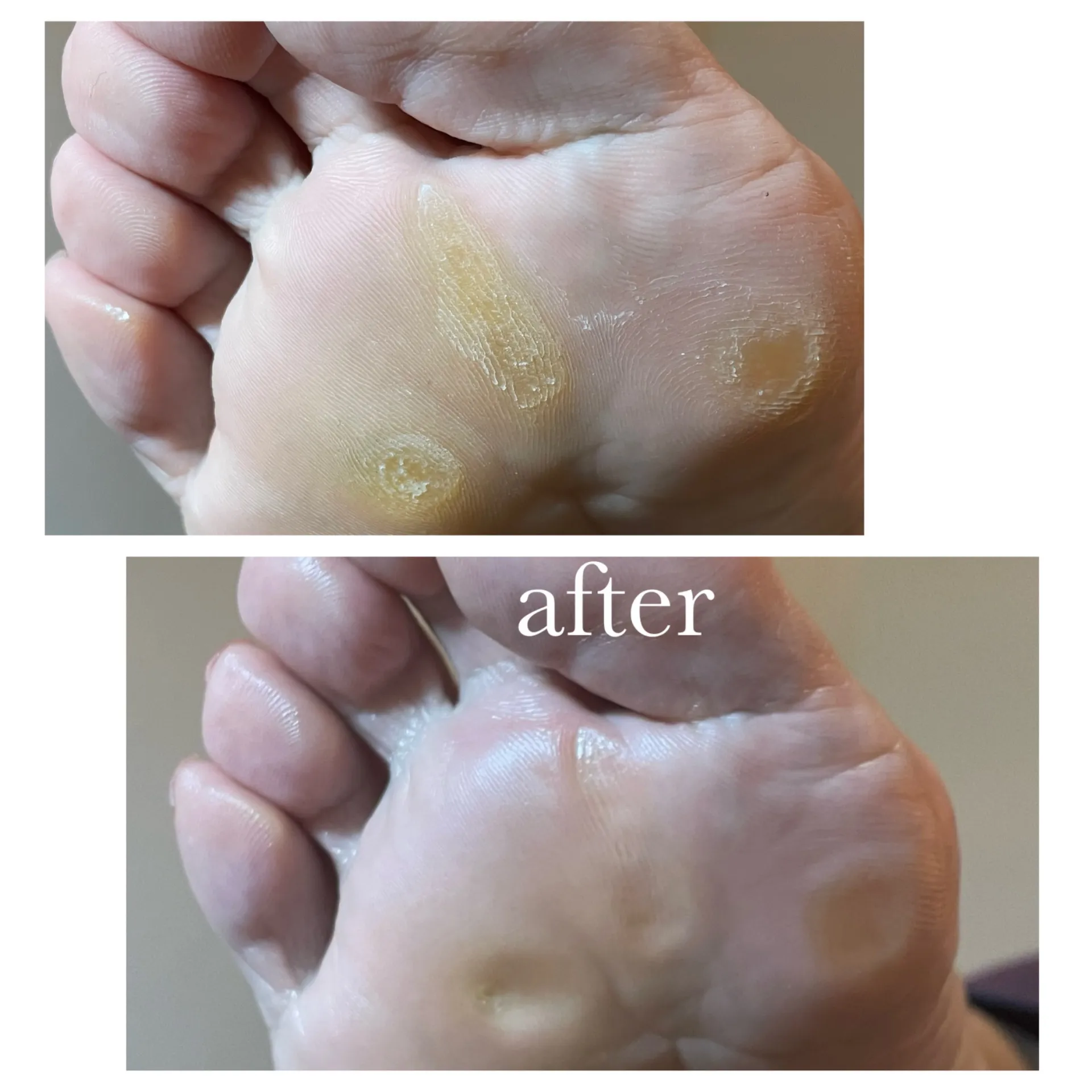 やっぱり足ケアはここ!