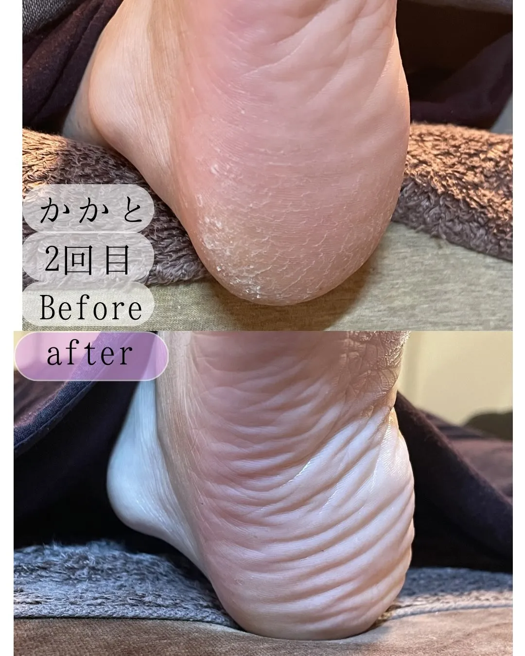 肌本来の柔らかさへ★2回目からの期間内ケアが大切